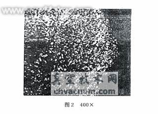 铬镍钢齿轮渗碳淬火新工艺
