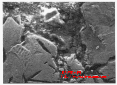 复合层中碳化硅颗粒×3000